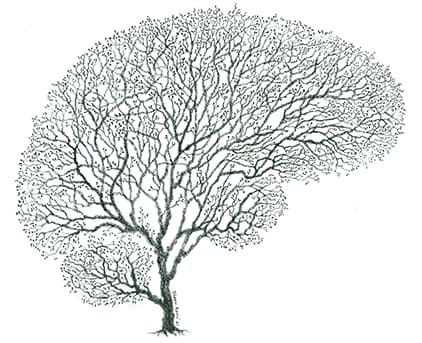 <p data-block-key="lyfi3">Aivopuu.</p>